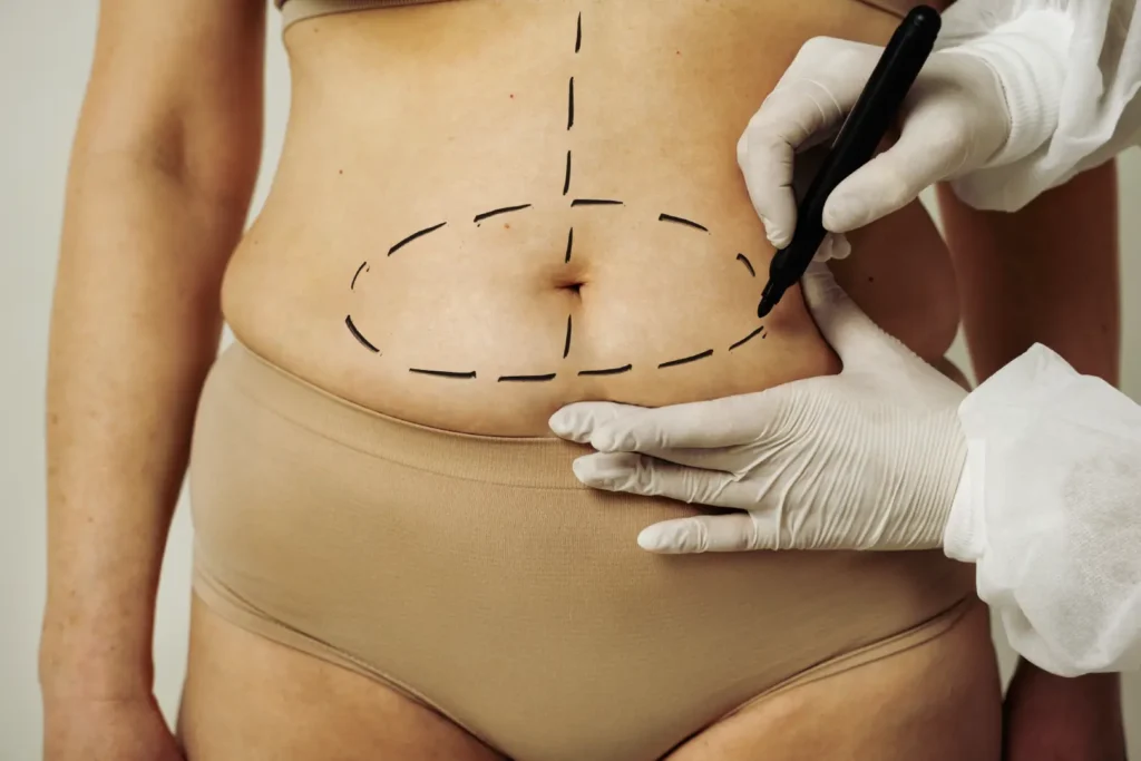 Consulta sobre lipofilling en la Clínica Rocío Vázquez