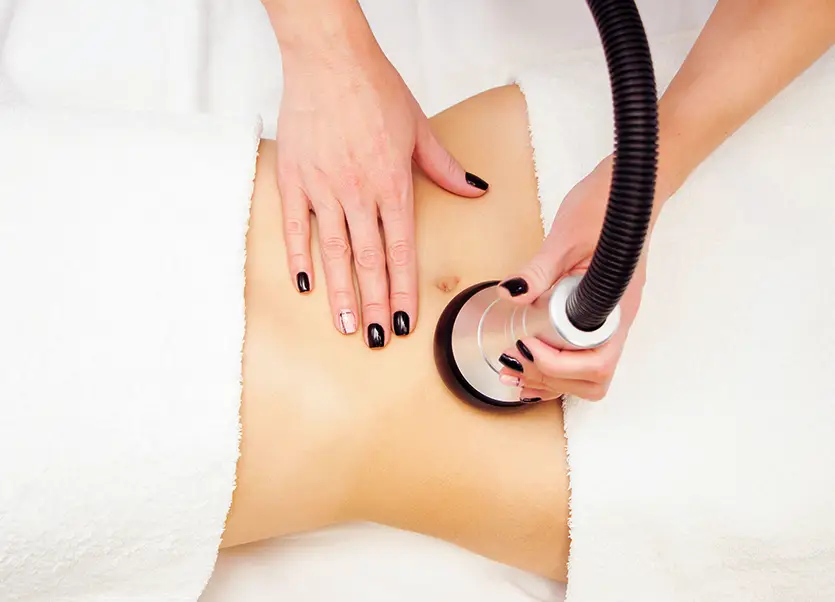 Aplicación de ondas de choque BTL en muslo para celulitis en Sevilla