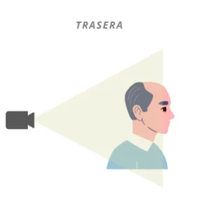 Tratamiento trasera capilar clínica Rocío Vázquez
