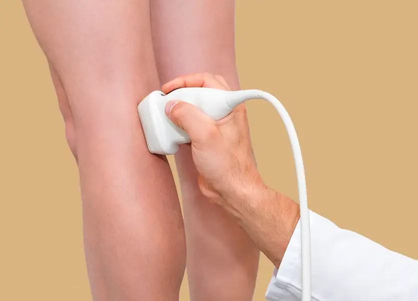 Tratamiento láser de varices en Sevilla