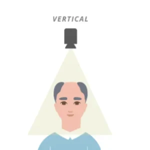 Tratamiento vertical clínica Rocío Vázquez