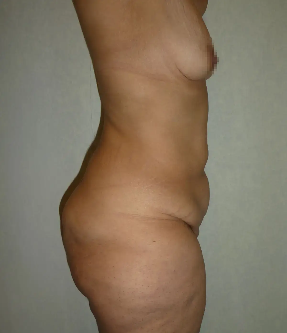 ANTES