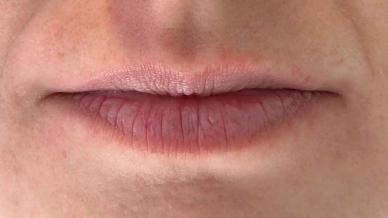 ANTES