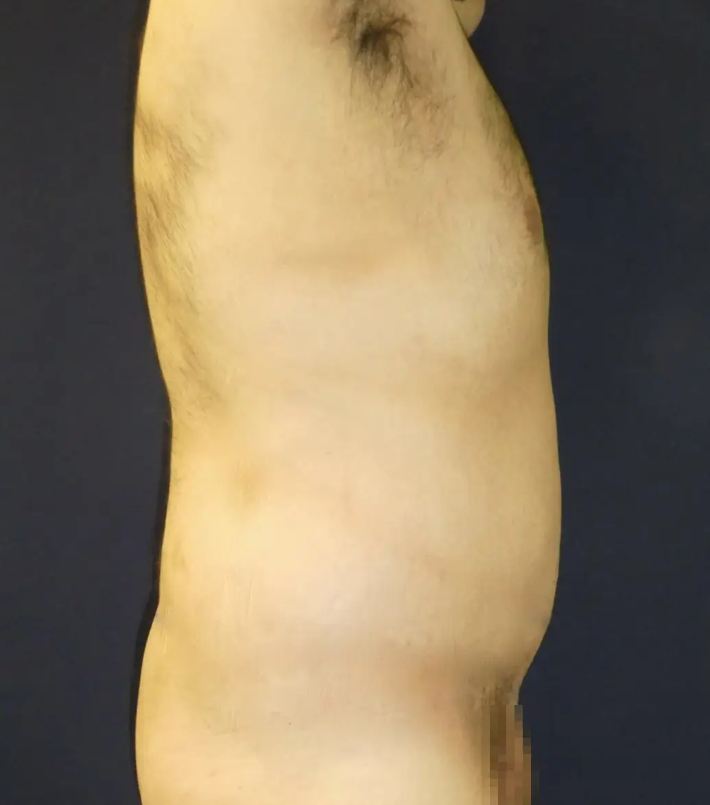 DESPUÉS